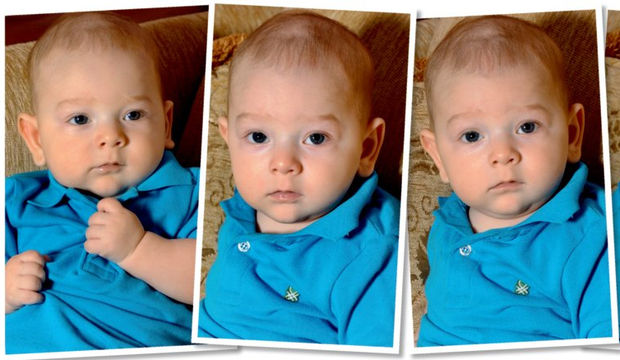 Ege'yle doktorları bile şaşırttık!