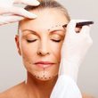 Face lifting nedir?