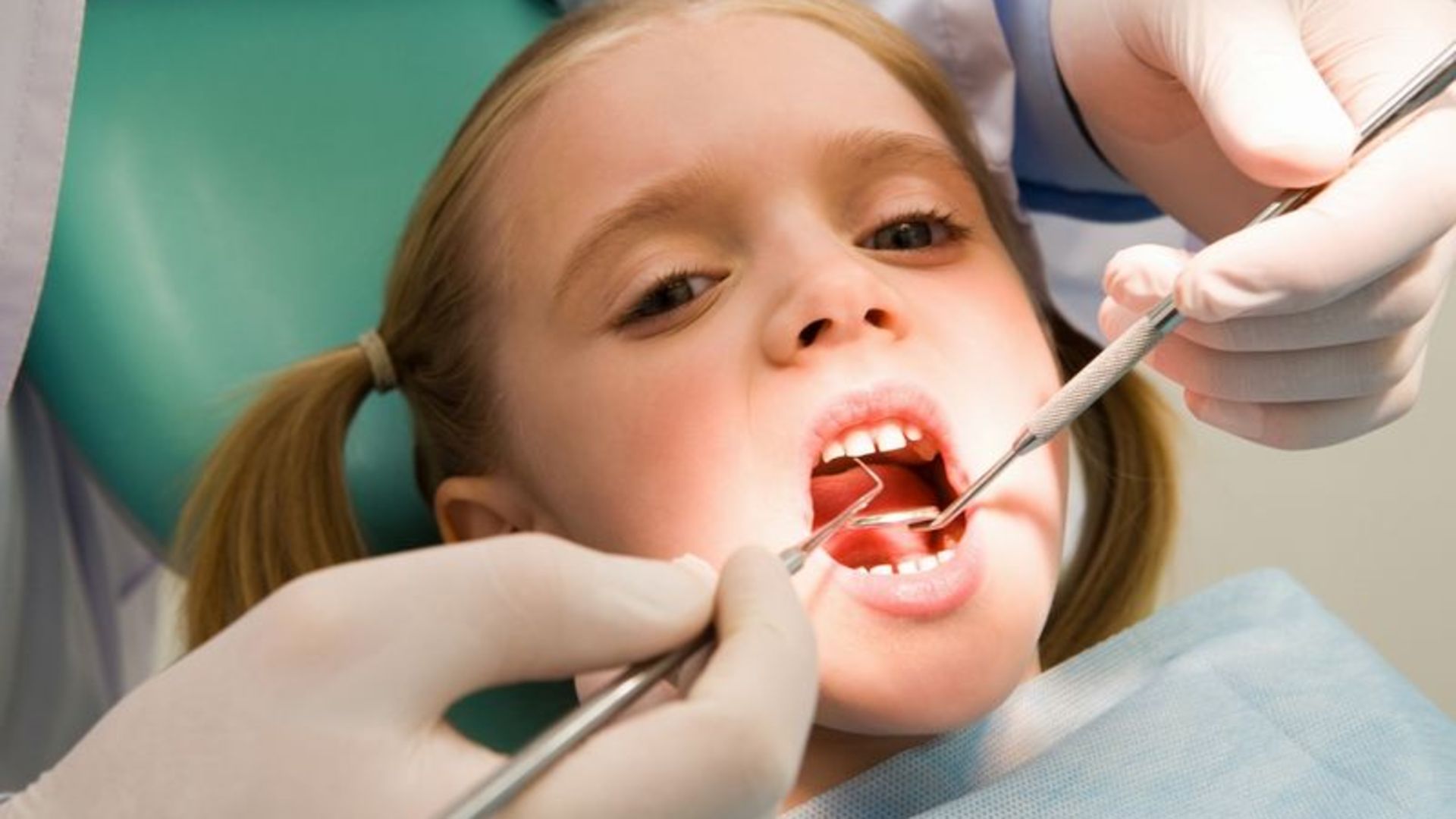 Пульпит детская стоматология
