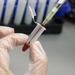 Üçlü test hakkında merak edilenler