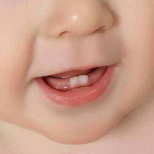 Bebeğinizin rahat diş çıkarması için öneriler