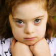 Down sendromu çocuğu nasıl etkiler?