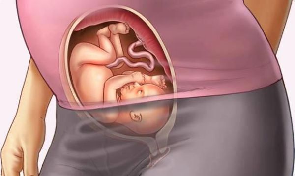 ortu genel bakis materyalizm 25 haftalik gebelikte bebek kilosu ve boyu sudecicekcilik net