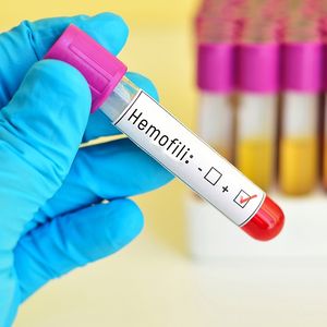 Kalıtsal kan hastalığı: Hemofili