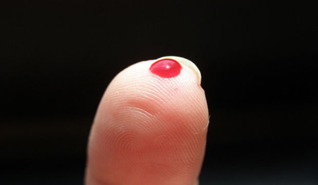 Kan grubu felç riskini etkiliyor...