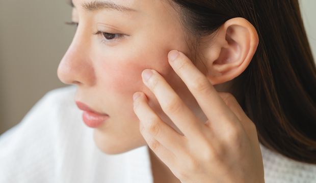 Sağlıklı bir cilt için tüketilmesi gereken besinler neler?