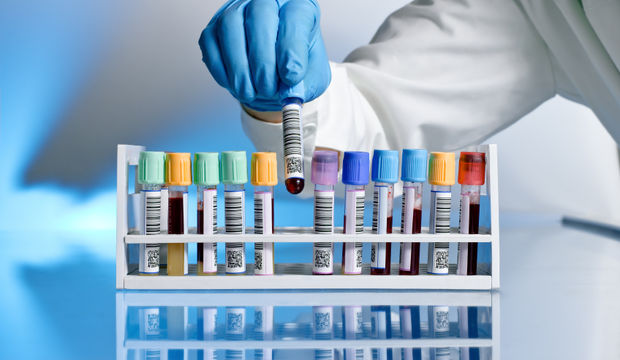 Kanser tedavisinde yeni bir umut