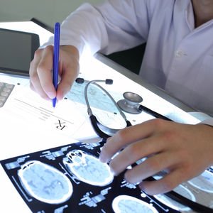 Epilepsi hakkında her şey!