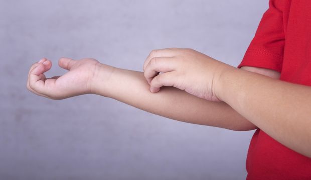 Bebeklerde Alerji Nasil Anlasilir Bebeklerde Ve Cocuklarda Besin Alerjisine Ne Iyi Gelir Bebek Haberleri
