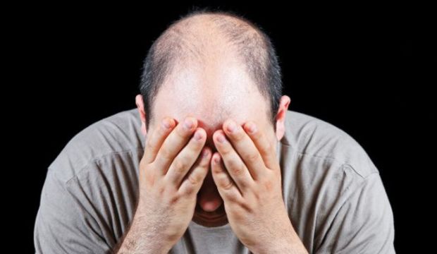 Saç dökülmesi derdinden kurtulun!