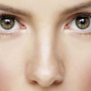 Ülkemizde burun estetiği  lüks değil! 