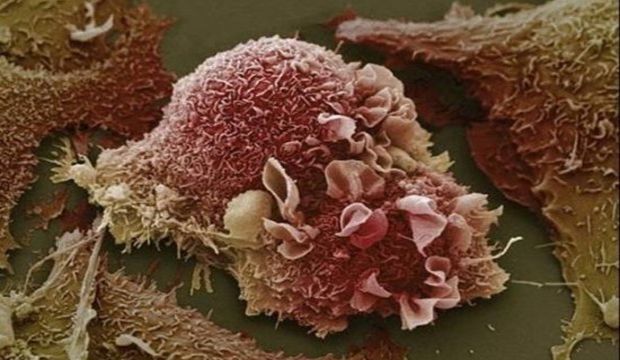 ABD’de et yiyen bakteri dehşeti