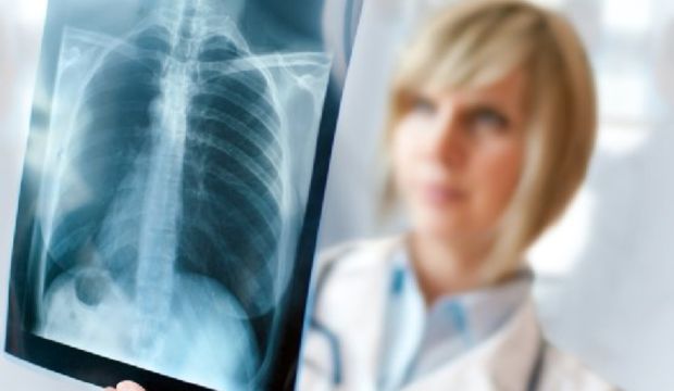 Dikkat bu belirtiler kanser işareti olabilir!