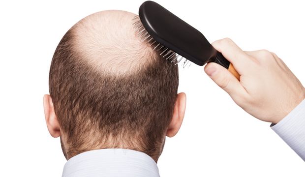 İktidarsızlık mı? Kellik mi?