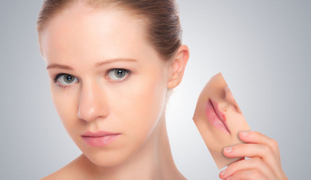 Uçuklara dereotuyla son!