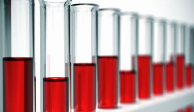 AIDS psikolojik olarak da zarar veriyor