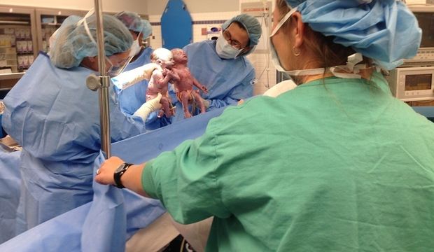 İkizlerden hayata el ele ‘Merhaba’