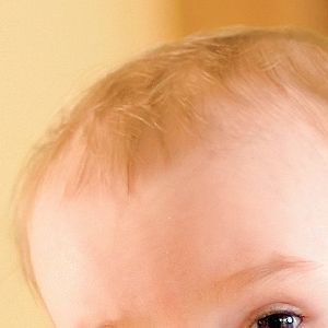 0-3 yaş bebelerine terapi