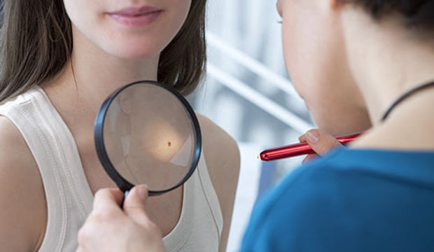 En sık görülen deri hastalığı: Molluskum Kontagiozum