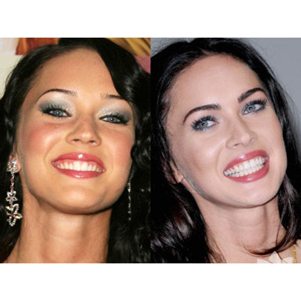 Зубы у звезд до и после фото