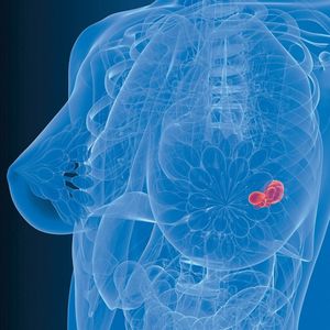 Kansere rağmen mesaiye devam