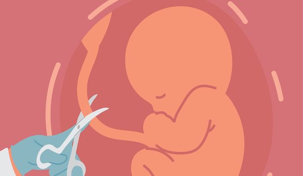 Göbek kordonu ve ince motor beceriler...