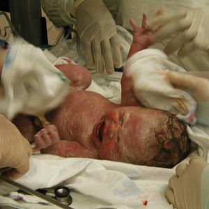 Kordon kanı saklanmalı mı?