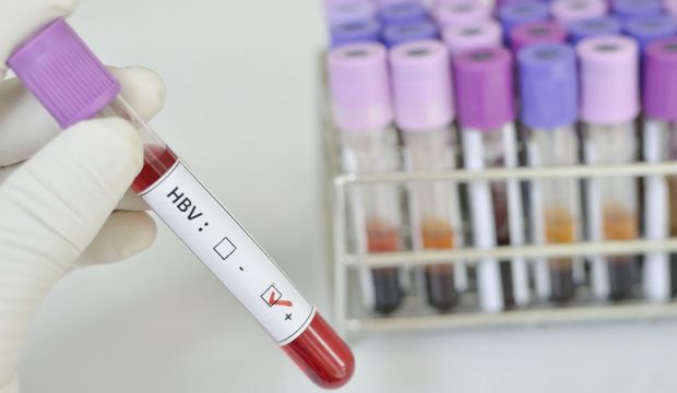 Sarılık belirtileri nelerdir?