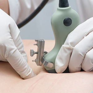 Bebeğim Down Sendromlu olabilir mi?