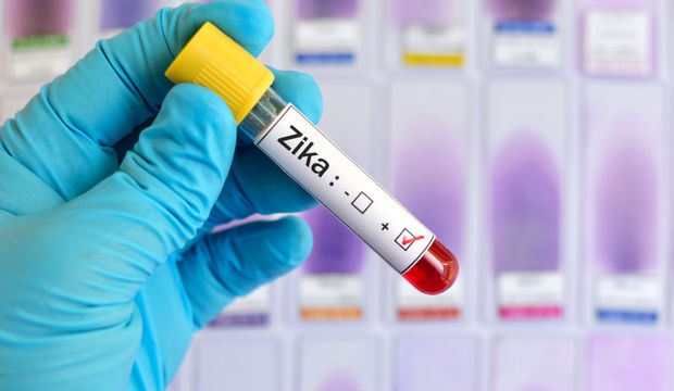 Zika virüsü nedir?