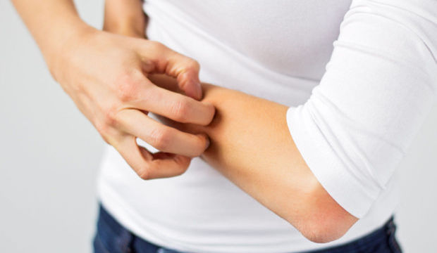 Stevens Johnson Sendromu nedir?