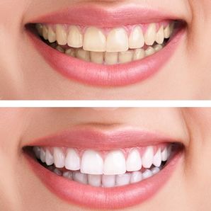 RESİMLİ TARÇINLI VE ŞEKERLİ SİMİT TARİFİ RESİMLİ TARÇINLI VE ŞEKERLİ SİMİT TARİFİ