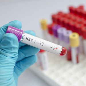 Bugün Dünya Hepatit Günü!