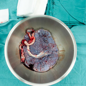 Plasentayı ne yapmalı?