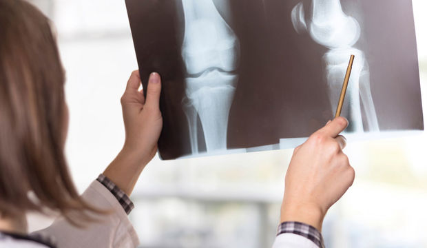 Kemik sağlığını korumanın yolları