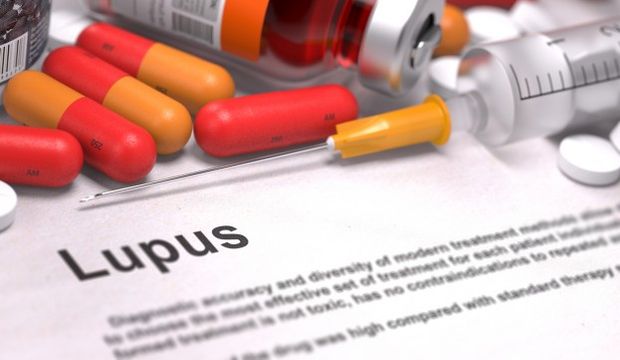 Lupus Sle Hastaligi Nedir Saglik