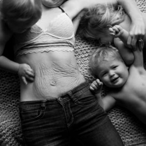 Yaralarımı kutluyorum