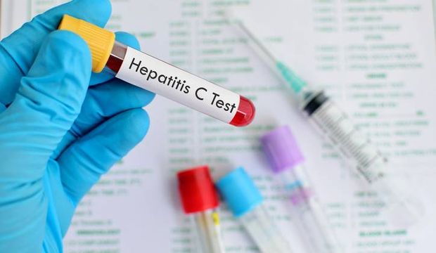 Güzelleşelim derken Hepatit C kapmayın!