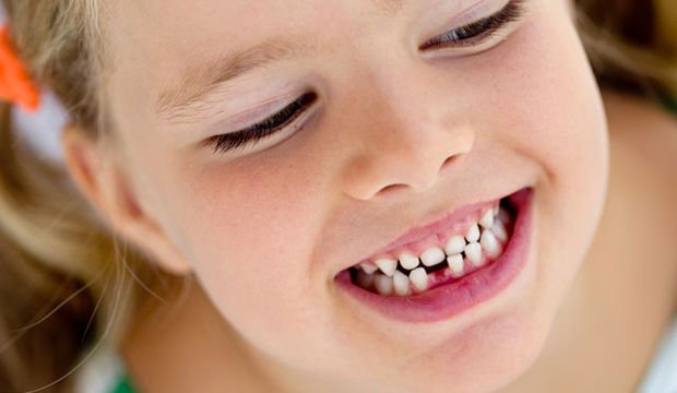 Çocuklarınızın dişlerine iyi bakıyor musunuz?
