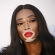 Vitiligo modeller