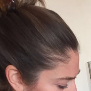 Ayurvedik meme bakımı ile ruhunuza dokunun!