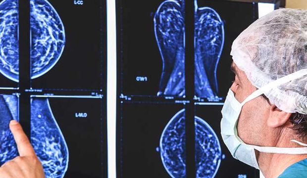 Mamografi çektirmek zararlı mıdır?