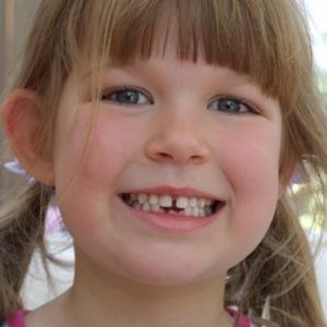 Çocukların diş problemlerinde acil müdahaleler