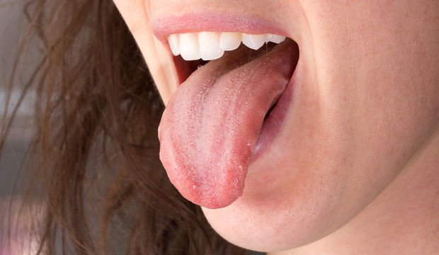 Dil kanseri nedir? Sağlık