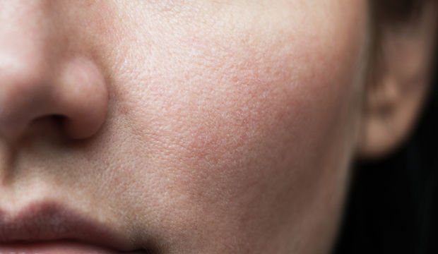 Cildi yaşlandıran faktörler neler?