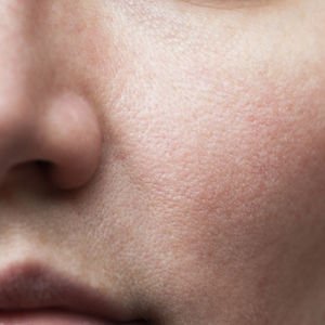 Cildi hızla yaşlandıran 10 alışkanlık