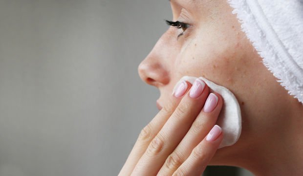 Akne nedir? Akne nasıl geçer?