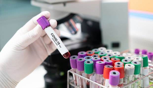 Kan grubu ve Korona ilişkisi