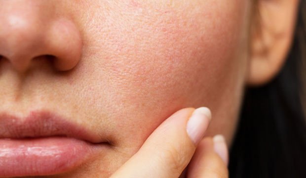 Hava kirliliği cildinize ne yapıyor?