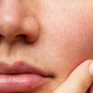 Hava kirliliğinin cildinize etkileri